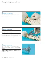 Предварительный просмотр 14 страницы Synthes Spine Cable System Technical Manual