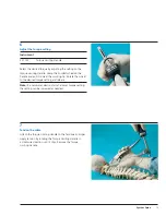 Предварительный просмотр 15 страницы Synthes Spine Cable System Technical Manual