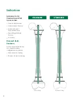 Preview for 9 page of Synthes The Titanium Femoral Nail System Technique Manual