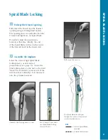 Preview for 42 page of Synthes The Titanium Femoral Nail System Technique Manual