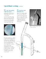 Preview for 45 page of Synthes The Titanium Femoral Nail System Technique Manual