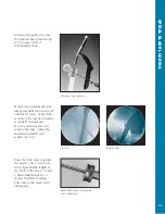 Preview for 46 page of Synthes The Titanium Femoral Nail System Technique Manual