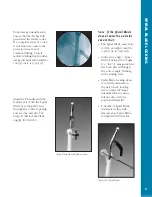 Preview for 48 page of Synthes The Titanium Femoral Nail System Technique Manual