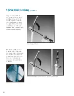 Preview for 49 page of Synthes The Titanium Femoral Nail System Technique Manual