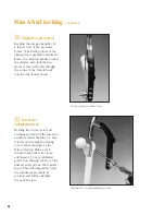 Preview for 59 page of Synthes The Titanium Femoral Nail System Technique Manual