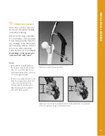 Preview for 60 page of Synthes The Titanium Femoral Nail System Technique Manual