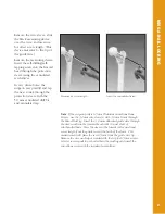 Preview for 62 page of Synthes The Titanium Femoral Nail System Technique Manual