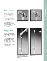 Preview for 68 page of Synthes The Titanium Femoral Nail System Technique Manual