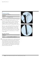 Preview for 10 page of Synthes Titanium Trochanteric Fixation
Nail System Technique Manual