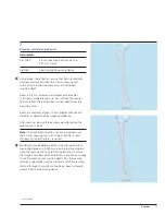 Preview for 15 page of Synthes Titanium Trochanteric Fixation
Nail System Technique Manual