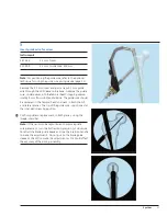 Preview for 23 page of Synthes Titanium Trochanteric Fixation
Nail System Technique Manual