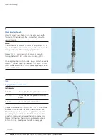 Preview for 30 page of Synthes Titanium Trochanteric Fixation
Nail System Technique Manual