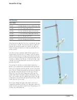 Preview for 41 page of Synthes Titanium Trochanteric Fixation
Nail System Technique Manual