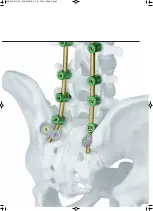 Preview for 5 page of Synthes USS II Polyaxial Technique Manual