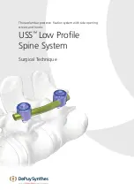 Preview for 1 page of Synthes USS Low Profile Surgical Technique