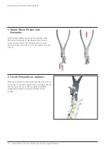 Preview for 18 page of Synthes USS Low Profile Surgical Technique