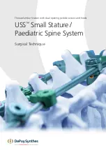 Preview for 1 page of Synthes USS Small Stature/Paediatric Spine System Manual