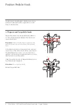 Preview for 10 page of Synthes USS Small Stature/Paediatric Spine System Manual