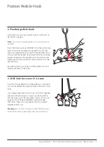 Preview for 11 page of Synthes USS Small Stature/Paediatric Spine System Manual