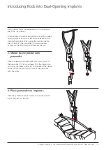 Preview for 17 page of Synthes USS Small Stature/Paediatric Spine System Manual