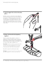 Preview for 18 page of Synthes USS Small Stature/Paediatric Spine System Manual