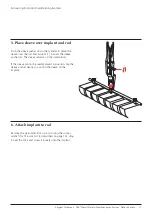 Preview for 19 page of Synthes USS Small Stature/Paediatric Spine System Manual