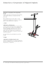 Preview for 20 page of Synthes USS Small Stature/Paediatric Spine System Manual