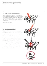 Preview for 11 page of Synthes USS Universal Surgical Technique