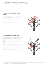 Preview for 12 page of Synthes USS Universal Surgical Technique