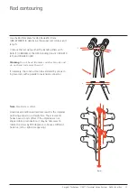 Preview for 13 page of Synthes USS Universal Surgical Technique