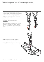 Preview for 14 page of Synthes USS Universal Surgical Technique