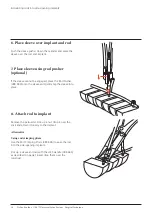 Preview for 16 page of Synthes USS Universal Surgical Technique