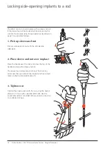 Preview for 18 page of Synthes USS Universal Surgical Technique