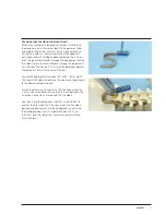 Preview for 33 page of Synthes VEPTR Technical Manual