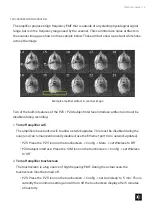 Предварительный просмотр 14 страницы TDT fMRI User Manual