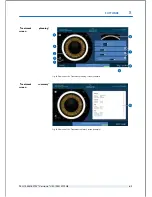 Preview for 73 page of Technolas Victus User Manual