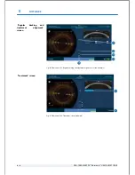 Preview for 74 page of Technolas Victus User Manual