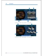 Preview for 78 page of Technolas Victus User Manual