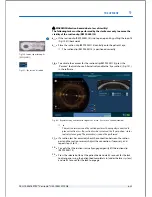 Preview for 143 page of Technolas Victus User Manual