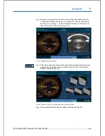 Preview for 165 page of Technolas Victus User Manual