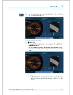 Preview for 167 page of Technolas Victus User Manual