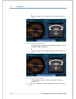 Preview for 172 page of Technolas Victus User Manual