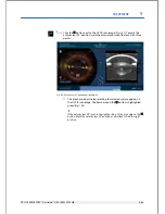 Preview for 175 page of Technolas Victus User Manual