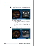 Preview for 176 page of Technolas Victus User Manual