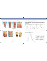 Preview for 25 page of TensCare Flexistim Instructions For Use Manual