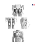 Preview for 87 page of TensCare perfect BEAUTY Instructions For Use Manual