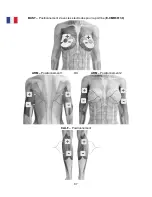 Preview for 88 page of TensCare perfect BEAUTY Instructions For Use Manual