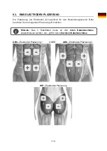 Preview for 115 page of TensCare Perfect EMS Instructions For Use Manual