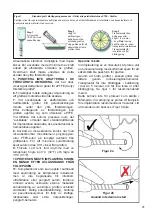 Предварительный просмотр 41 страницы Terumo Vascutek ePTFE Instructions For Use Manual