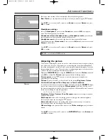 Preview for 11 page of THOMSON Intuiva IFC130 Owner'S Manual